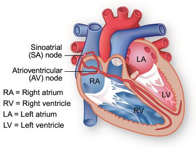 Aritmija srca 76